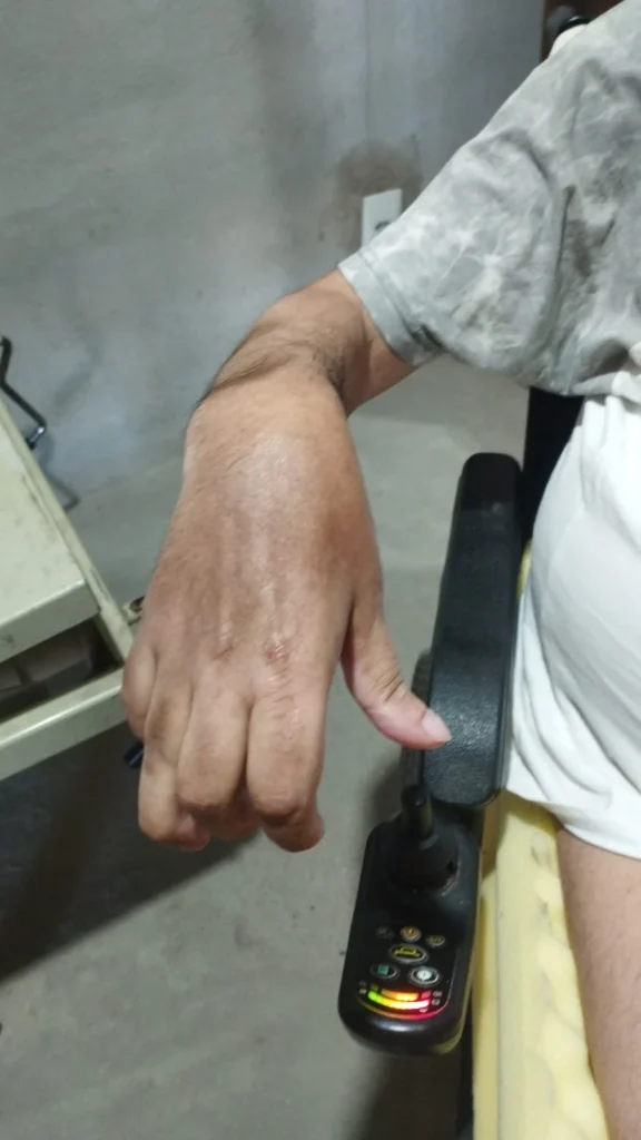 Foto real das mãos de Ronaldo, mostrando posição dos dedos e punho.