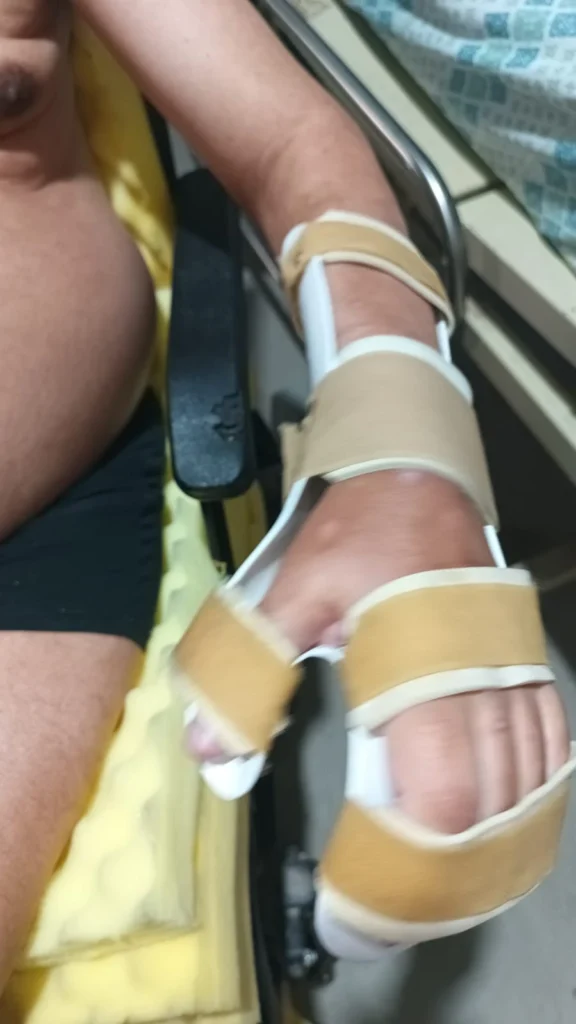 Ronaldo usando órtese de punho e mão com estrutura rígida e tiras de velcro